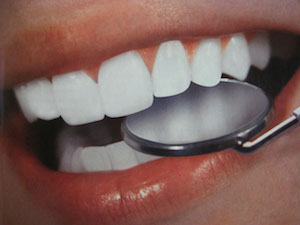 Ästhetische Zahnheilkunde bei einer Untersuchung in der Zahnarztpraxis Jgubuia