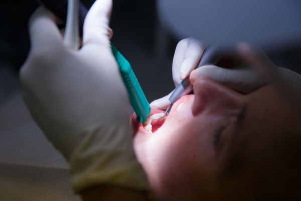 Eine Patienten aus Hannover lässt sich den Zahnstein entfernen. 